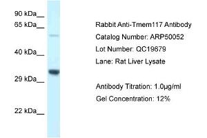 WB Suggested Anti-Tmem117 Antibody   Titration: 1. (TMEM117 抗体  (C-Term))