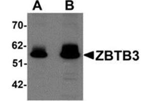 Western blot analysis of ZBTB3 in rat brain tissue lysate with ZBTB3 antibody at (A) 1 and (B) 2 μg/ml. (ZBTB3 抗体  (C-Term))