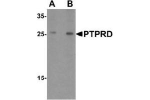 Western blot analysis of PTPRD in HeLa cell lysate with PTPRD Antibody  at (A) 1 and (B) 2 ug/mL. (PTPRD 抗体  (N-Term))