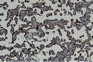 Immunohistochemistry (IHC) image for anti-Gastrulation Brain Homeo Box 2 (GBX2) (Internal Region) antibody (ABIN334408)
