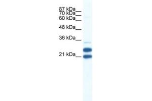 Western Blotting (WB) image for anti-Tripartite Motif Containing 34 (TRIM34) antibody (ABIN2461044) (TRIM34 抗体)