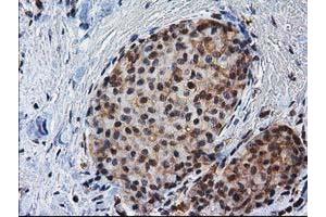 Immunohistochemistry (IHC) image for anti-Nonhomologous End-Joining Factor 1 (NHEJ1) antibody (ABIN1499728)