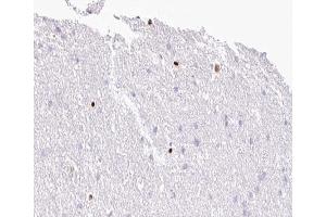 ABIN6267006 at 1/100 staining human Brain tissue sections by IHC-P. (MOK 抗体  (Internal Region))