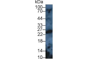 Detection of PRDX3 in Rat Serum using Polyclonal Antibody to Peroxiredoxin 3 (PRDX3) (Peroxiredoxin 3 抗体  (AA 5-233))