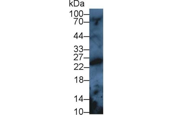 Peroxiredoxin 3 anticorps  (AA 5-233)