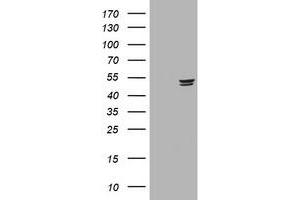 Image no. 2 for anti-Thymidine Phosphorylase (TYMP) (AA 311-482) antibody (ABIN1491400)