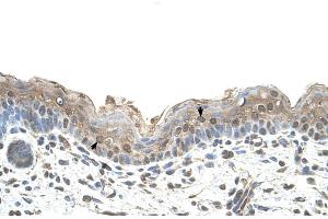 Immunohistochemistry (IHC) image for anti-Ribophorin II (RPN2) (N-Term) antibody (ABIN2782203)