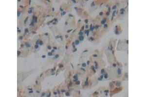 IHC-P analysis of Human Tissue, with DAB staining. (TBK1 抗体  (AA 9-310))