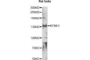 Western blot analysis of extracts of rat testis, using KCNU1 antibody (ABIN6293996) at 1:1000 dilution. (KCNU1 抗体)