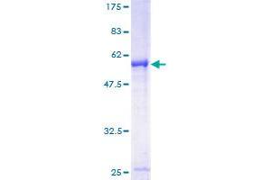 Image no. 1 for Immediate Early Response 2 (IER2) (AA 1-223) protein (GST tag) (ABIN1307393) (IER2 Protein (AA 1-223) (GST tag))