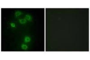 Immunofluorescence analysis of A549 cells, using BMX antibody. (BMX 抗体  (N-Term))