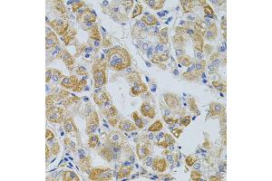 Immunohistochemistry of paraffin-embedded human stomach using PCSK9 antibody (ABIN5975791) at dilution of 1/100 (40x lens).