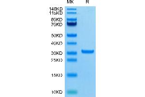 SARS-CoV-2 3CLpro (A191T) on Tris-Bis PAGE under reduced condition. (SARS-Coronavirus Nonstructural Protein 8 (SARS-CoV NSP8) (A191T) 蛋白)