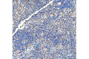 IHC analysis of DDX1 using anti-DDX1 antibody (ABIN7602050). (DDX1 抗体  (AA 562-740))