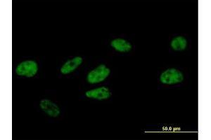 Immunofluorescence of purified MaxPab antibody to FBXO34 on HeLa cell. (FBXO34 抗体  (AA 1-711))