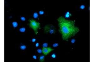 Anti-MAPK7 mouse monoclonal antibody (ABIN2454051) immunofluorescent staining of COS7 cells transiently transfected by pCMV6-ENTRY MAPK7 (RC203506). (MAPK7 抗体)