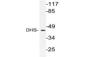 Western blot (WB) analysis of DHS antibody in extracts from 3T3 cells. (DHPS 抗体)