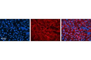 DHODH antibody - C-terminal region          Formalin Fixed Paraffin Embedded Tissue:  Human Liver Tissue    Observed Staining:  Cytoplasm in hepatocytes   Primary Antibody Concentration:  1:100    Secondary Antibody:  Donkey anti-Rabbit-Cy3    Secondary Antibody Concentration:  1:200    Magnification:  20X    Exposure Time:  0. (DHODH 抗体  (C-Term))