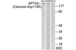 Western blot analysis of extracts from HeLa/A549 cells, treated with etoposide 25uM 24H, using SPTA2 (Cleaved-Asp1185) Antibody. (SPTAN1 抗体  (Cleaved-Asp1185))