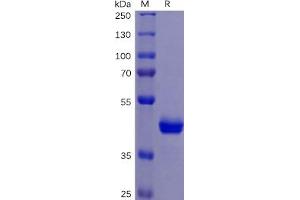 Human TNFRSF10B Protein, mFc Tag on SDS-PAGE under reducing condition. (TNFRSF10B Protein (mFc Tag))