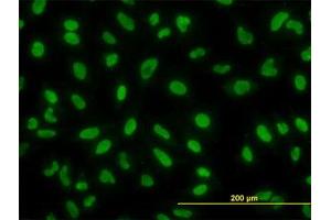 Image no. 2 for anti-YY1 Transcription Factor (YY1) (AA 221-321) antibody (ABIN599012) (YY1 抗体  (AA 221-321))