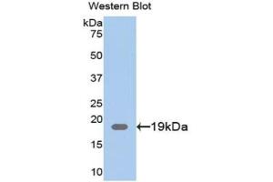 Western blot analysis of the recombinant protein. (CLIC4 抗体  (AA 104-253))