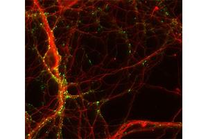 Immunocytochemistry (ICC) image for anti-Tubulin, beta 3 (TUBB3) (AA 443-450) antibody (ABIN1742554) (TUBB3 抗体  (AA 443-450))