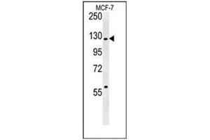 Western blot analysis of RABGAP1 Antibody (N-term) in MCF-7 cell line lysates (35ug/lane). (RABGAP1 抗体  (N-Term))