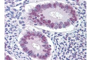 Immunohistochemistry (IHC) image for anti-serine/threonine Kinase 17a (STK17A) (AA 301-414) antibody (ABIN614691) (STK17A 抗体  (AA 301-414))