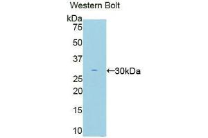 Western blot analysis of the recombinant protein. (EIF2AK2 抗体  (AA 279-506))