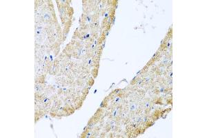 Immunohistochemistry of paraffin-embedded mouse heart using COX6B1 antibody (ABIN5974626) at dilution of 1/100 (40x lens). (COX6B1 抗体)