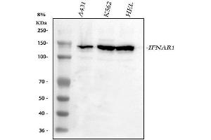 Western blot analysis of IFNAR1 using anti-IFNAR1 antibody (ABIN5518761).