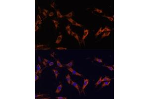 Immunofluorescence analysis of C6 cells using KSR1 Polyclonal Antibody (ABIN7268119) at dilution of 1:100 (40x lens). (KSR1 抗体  (AA 320-420))