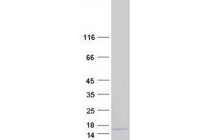 Western Blotting (WB) image for Islet Amyloid Polypeptide (IAPP) protein (Myc-DYKDDDDK Tag) (ABIN2714675)