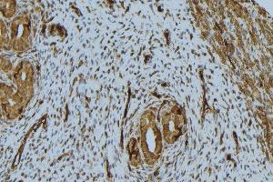 ABIN6276760 at 1/100 staining Human uterus tissue by IHC-P.