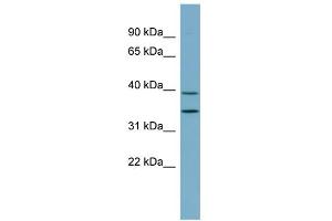 WB Suggested Anti-PRKAB1 Antibody Titration: 0. (PRKAB1 抗体  (N-Term))