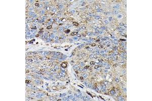 Immunohistochemistry (IHC) image for anti-Protein Regulator of Cytokinesis 1 (PRC1) (AA 351-620) antibody (ABIN6146124)