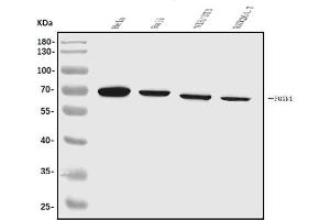 Western blot analysis of FOXN1 using anti-FOXN1 antibody (ABIN7603147).