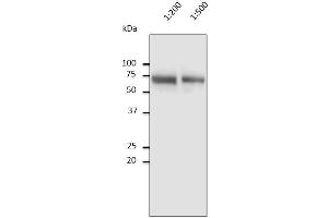 Anti-Albumin Ab at 1/2,500 dilution, 10 µl of diluted human serum per Iane, Rabbit polyclonal to goat IgG (HRP) at 1/10,000 dilution, (Albumin 抗体)