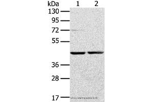 Western blot analysis of Hepg2 and hela cell, using RRAGA Polyclonal Antibody at dilution of 1:400 (RRAGA 抗体)