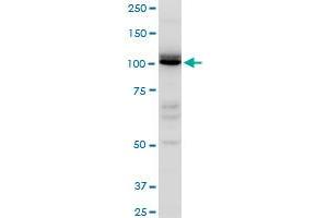 IDE polyclonal antibody (A01), Lot # ABNOVA060711QCS1. (IDE 抗体  (AA 920-1019))