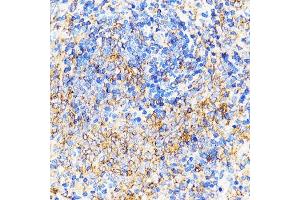 Immunohistochemistry of paraffin-embedded Rat spleen using CXCR2 Rabbit pAb (ABIN1680461, ABIN3017662, ABIN3017663 and ABIN6220198) at dilution of 1:100 (40x lens). (CXCR2 抗体)