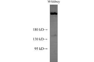 Western Blot analysis of Mouse kidney using Sptan1 Polyclonal Antibody at dilution of 1:1000 (SPTAN1 抗体)
