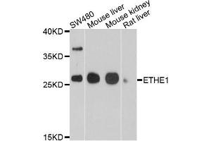 Western blot analysis of extracts of various cells, using ETHE1 antibody. (ETHE1 抗体)