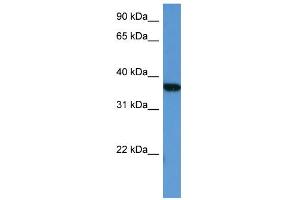WB Suggested Anti-MAPKAPK2 Antibody Titration: 0. (MAPKAP Kinase 2 抗体  (Middle Region))