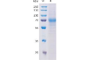 SDS-PAGE (SDS) image for Lymphocyte Antigen 9 (CD229) (AA 48-454) protein (His tag) (ABIN7092707)