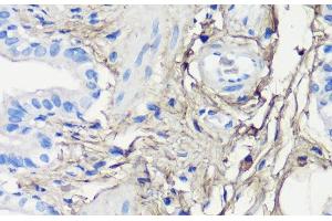 Immunohistochemistry of paraffin-embedded Rat lung using Decorin Polyclonal Antibody at dilution of 1:200 (40x lens). (Decorin 抗体)