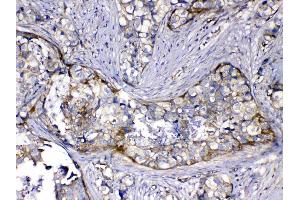 IHC analysis of HOMER3 using anti-HOMER3 antibody . (HOMER3 抗体  (AA 282-360))
