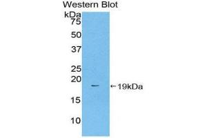 Western Blotting (WB) image for anti-Coagulation Factor II (thrombin) (F2) (AA 201-324) antibody (ABIN1859317) (Prothrombin 抗体  (AA 201-324))