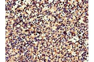 Immunohistochemistry of paraffin-embedded human spleen tissue using ABIN7146648 at dilution of 1:100 (CNR2 抗体  (AA 305-360))